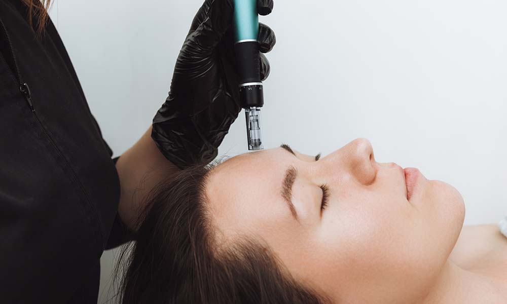 does skin needling hurt​