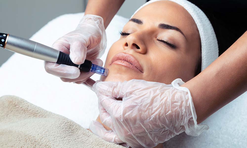 how much does skin needling cost​