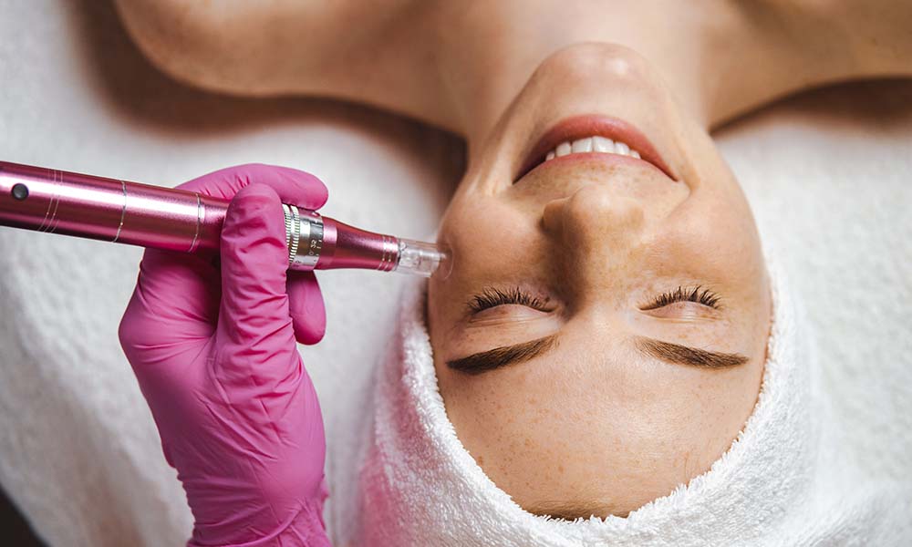 skin needling aftercare